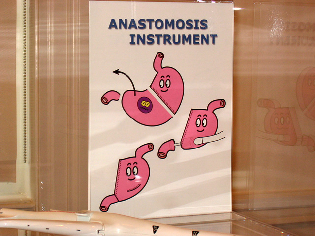 Anastomosis